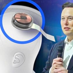 Elon Musk agy chip - Neuralink chip